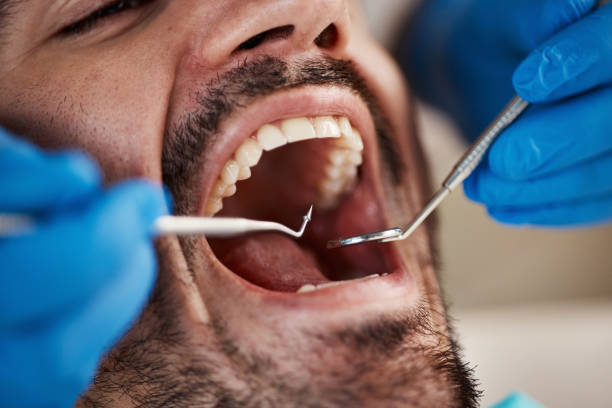 Laser Dentistry in Troup, TX